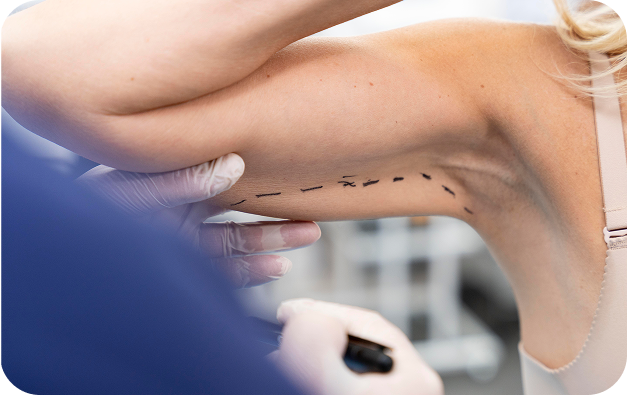 Clínica Cirugía Plástica en CDMX_Beneficios