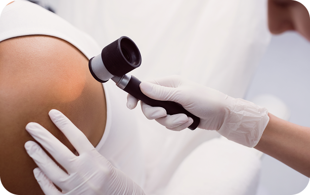 Dermatólogo en Ciudad de México_Beneficios