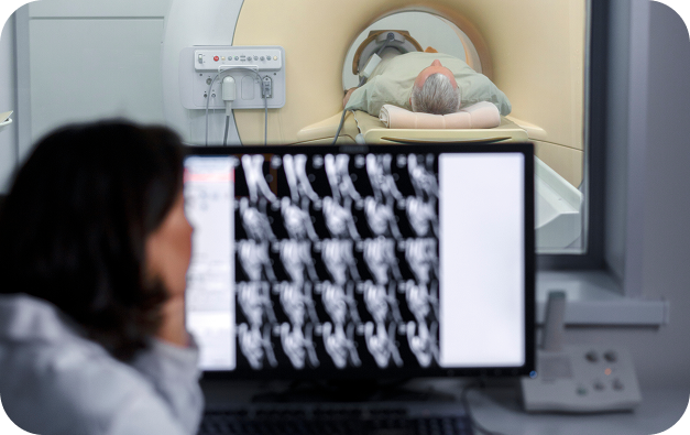 Radiología Intervencionista en Ciudad de México_Beneficios